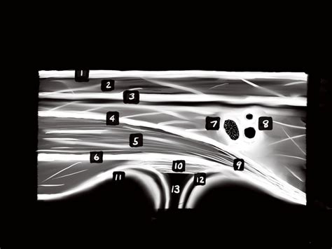 MSK Ultrasound - An IJSPT Perspective | Published in International Journal of Sports Physical ...