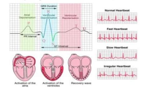 Image result for Heart Rhythm Monitoring Algorithm