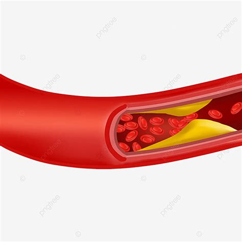 Blood Vessels Clipart PNG Images, Blood Vessels Block Human Arteries ...