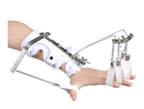 Best Custom Wrist, Elbow & Hand Orthosis – Comfort & Support