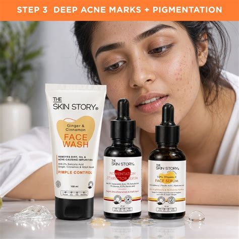 DEEP ACNE – The Skin Story