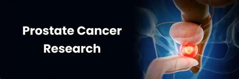 Advances in Prostate Cancer Research and Treatment in Vizag