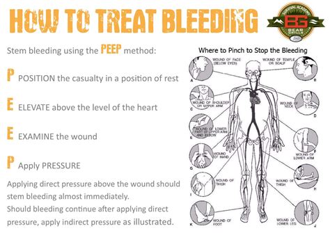 29 Outdoor First Aid ideas | first aid, survival skills, survival