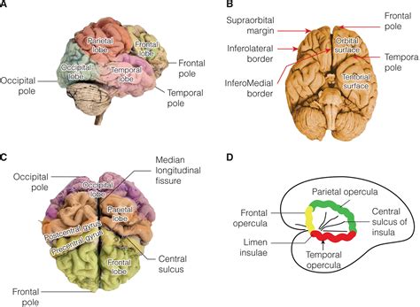 Transverse Temporal Sulcus