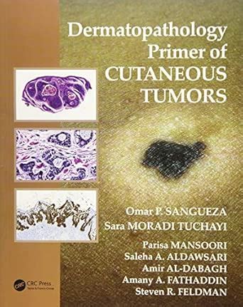 Buy DERMATOPATHOLOGY PRIMER OF CUTANEOUS TUMORS (PB 2016) Book Online ...