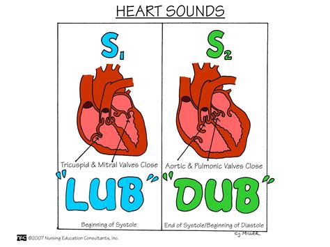 Heart Sounds Diagram S1 S2