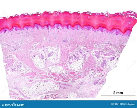 Keratinized Stratified Squamous Epithelium Epidermis