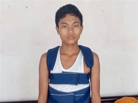 14 साल के किशोर की रीढ़ की हड्डी का जटिल ऑपरेशन कर दिया नया जीवन - PNI News
