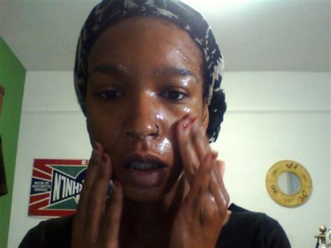 Image result for Toothpaste Causing Acne