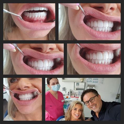 Onofrio Azzaretto on LinkedIn: yes we does typ of cases