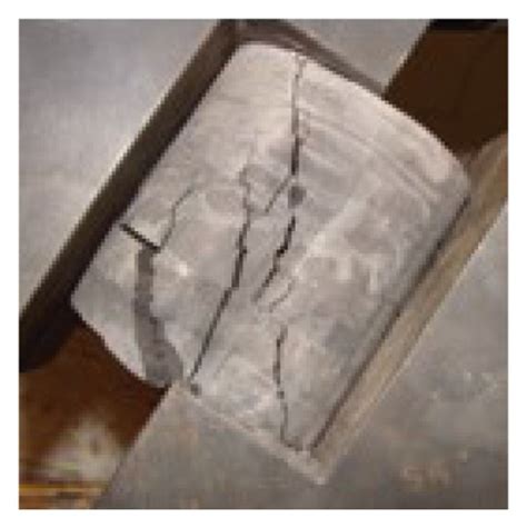 Image result for Compression Fracture Step Defect