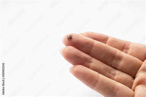 Image result for Embedded Deer Tick