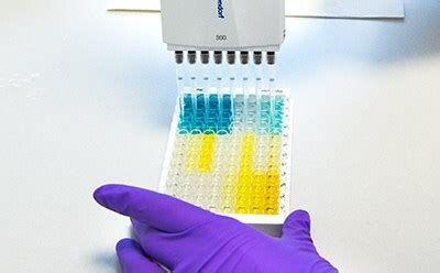 Pyrogen Testing Methods