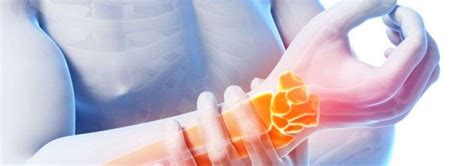 Carpal tunnel: what is it? - VEM Rental at home