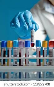 Bar Code Example 的图像结果