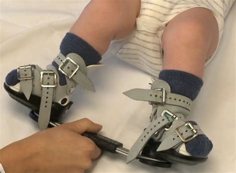 Evolution Health Care Pvt. Ltd. - Leaf Spring Ankle Foot Orthosis ...