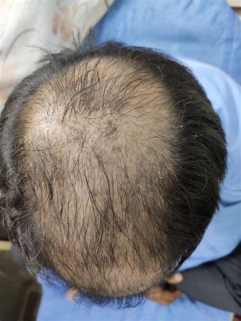 Aaryash Derma & Joint Ease Clinic