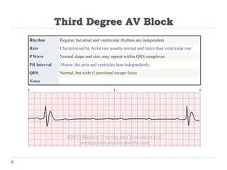 Image result for ACLS Code Blue Algorithm