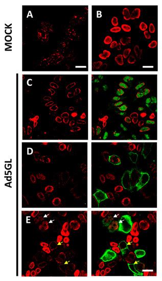 Viruses | September 2021 - Browse Articles