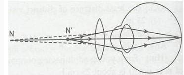 Make a diagram to show how hypermetropia is corrected. The near point ...