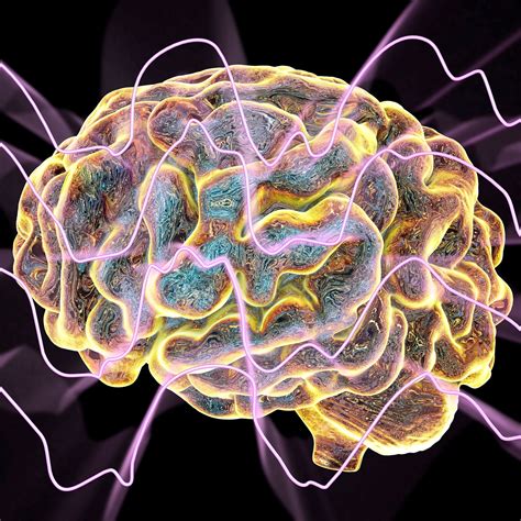 Image result for Exploding Head Syndrome While Awake