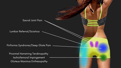 Image result for Lower Back Pain Chart