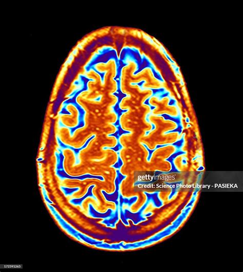 High Res Brain Scan Image 的图像结果