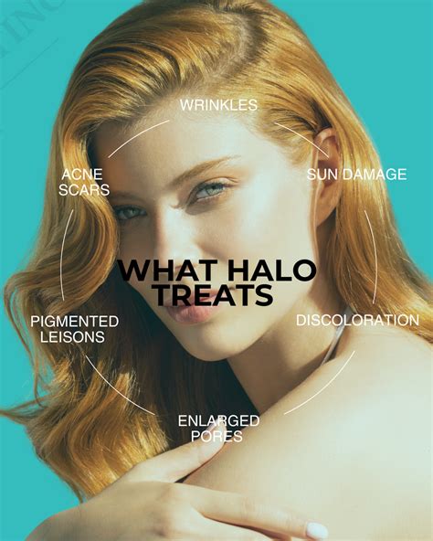 Halo Face – Balikian Plastic Surgery
