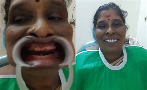 Sarvesh Dental Care - Best Dental Clinic in Chennai