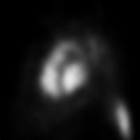 Image result for Muga Scan Lab Results