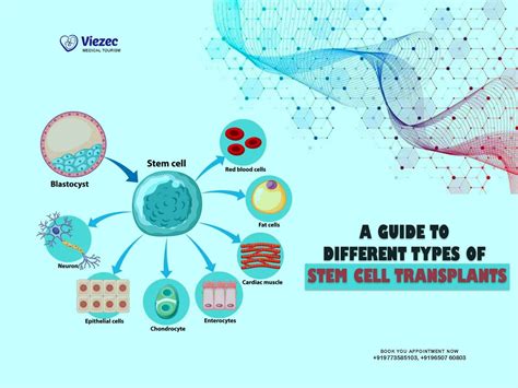 A Guide To Different Types Of Stem Cell Transplants