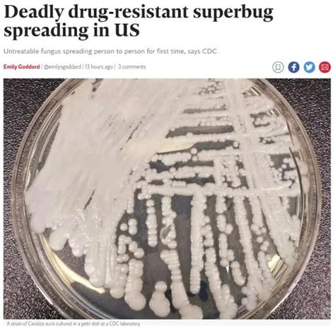 美CDC证实医疗机构爆“超级真菌”传播 已致3死 ＊ 阿波罗新闻网