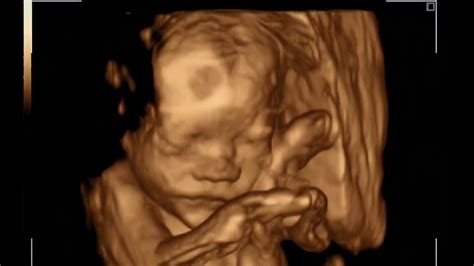 怀孕19周做四维彩超产检过程实录,宝宝的面部轮廓可以看得很清楚!-母婴亲子视频-搜狐视频