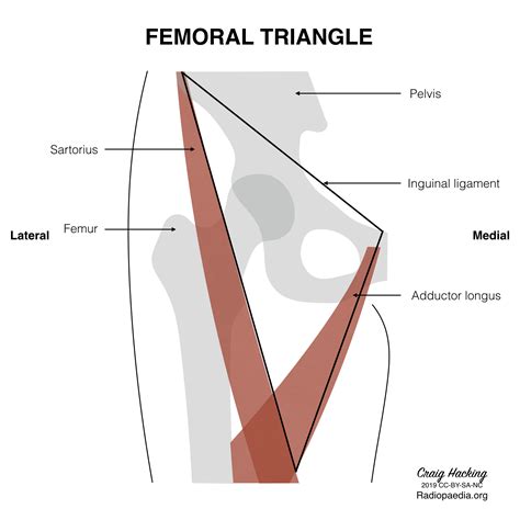 Radiopaedia - Drawing Boundaries of the femoral triangle - English labels | AnatomyTOOL
