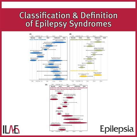 Epilepsy Wikipedia
