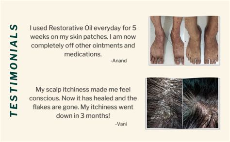 Oleum Cottage Restorative Oil for Skin Scalp Psoriasis and Eczema (50ml ...