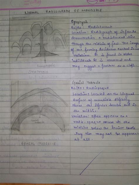 RADIOGRAPHIC ANATOMICAL MANDIBULAR LANDMARKS I – Dentowesome