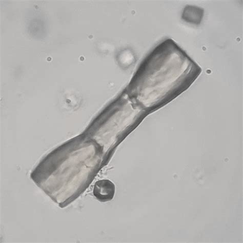 Image result for Transitional Epithelial Cells