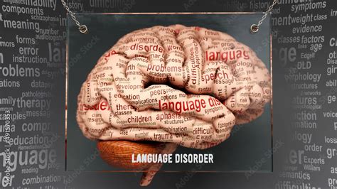 Language disorder anatomy - its causes and effects projected on a human brain revealing Language ...