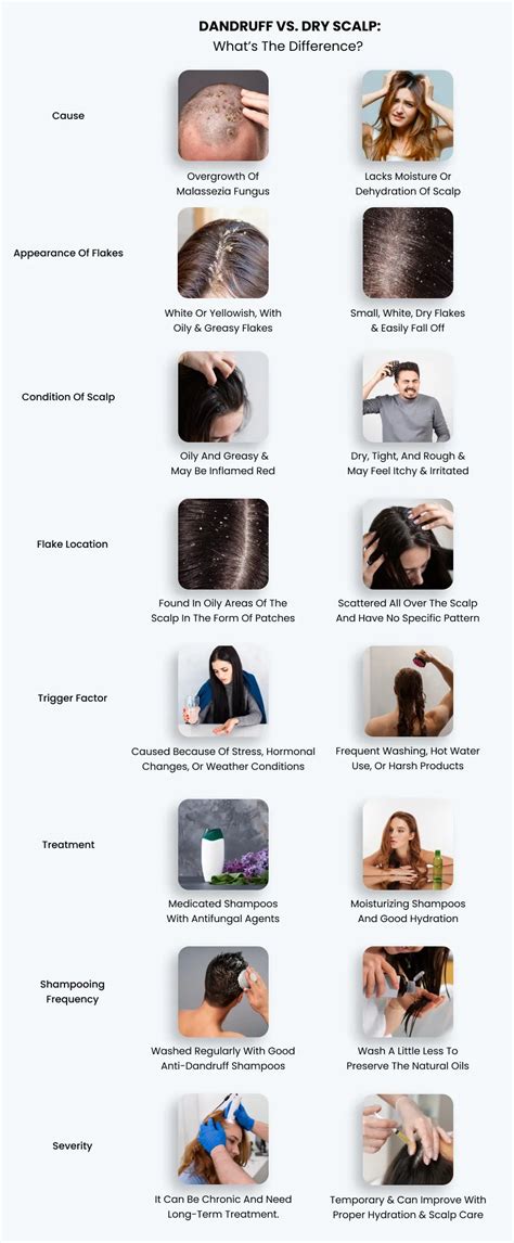 Dry Scalp Can be a Common Winter Hair Problem! Here’s How to Fix It ...