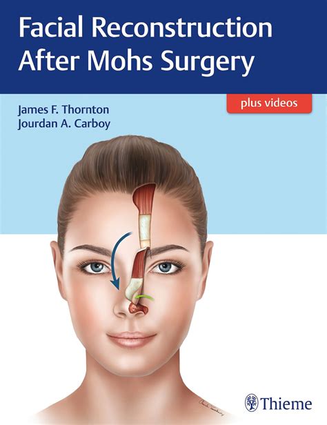 Facial Reconstruction After Mohs Surgery | 9781626237346 | Thieme Webshop