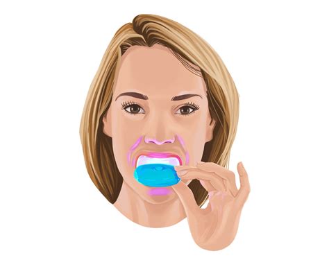 How to Whiten Dentures Safely (What Actually Works & What to Avoid ...