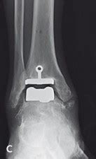 Hardware Monitor Driver 的图像结果