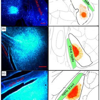 Image result for Fluoro Injection