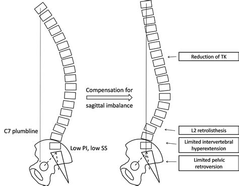 The radiographic characteristics and developmental mechanism of the ...