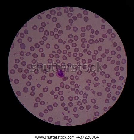 Image result for Monocyte Under Microscope