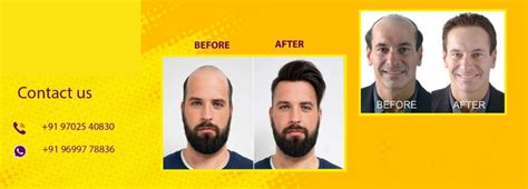 Hair wig center in Mumbai | Hair wig Manufacturers in Navi Mumbai