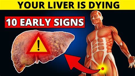 7 signs your liver is dying Android IOS V- 1.63