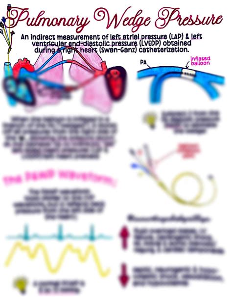 Pulmonary Wedge Pressure (PCWP) - Etsy