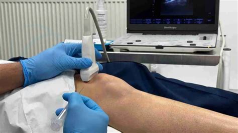 Steroid Injections for Knee Osteoarthritis Pain Relief